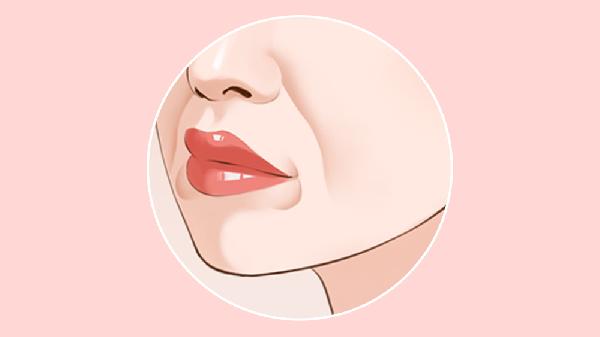 做硅胶植入去法令纹有哪些禁忌人群