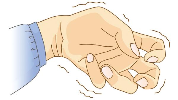 小儿良性癫痫会影响智力吗