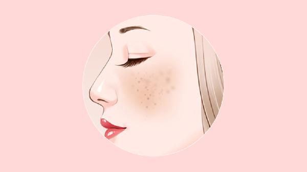 激光祛斑后反黑多久能恢复