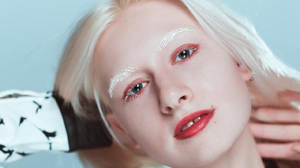 白化病皮肤晒红了怎么办