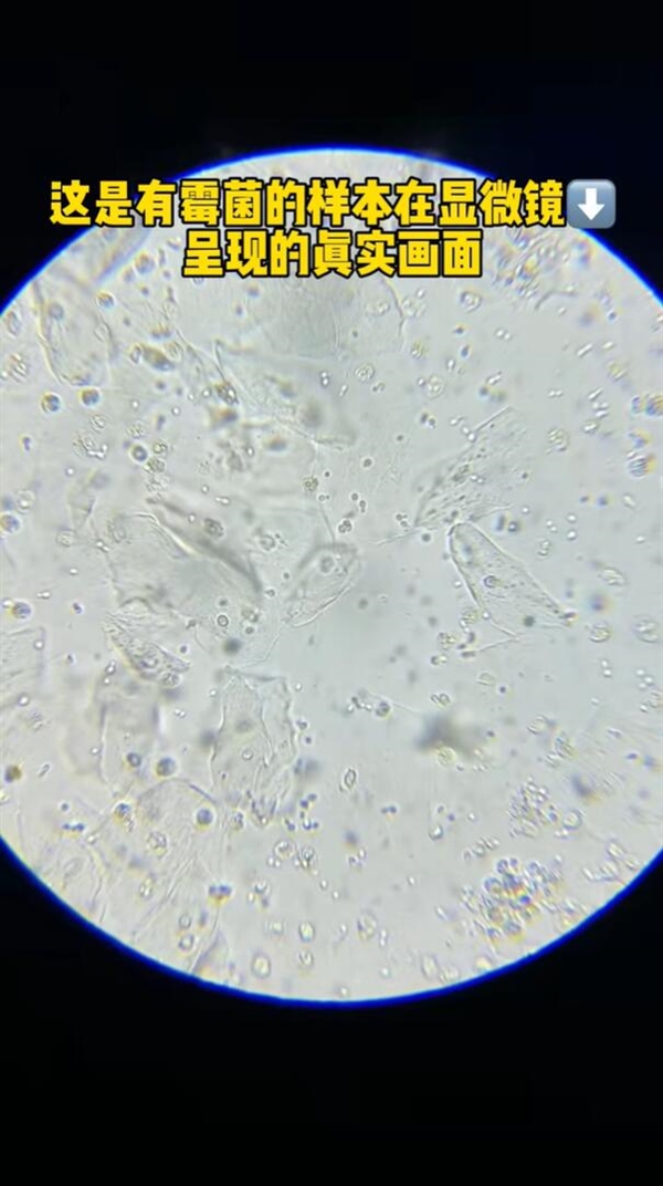 霉菌这种致癌物藏在家里:很多人浑然不知