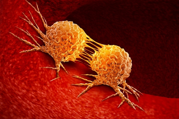 霉菌这种致癌物藏在家里:很多人浑然不知